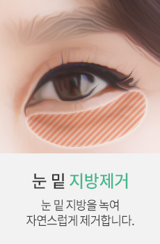 눈밑 지방제거
